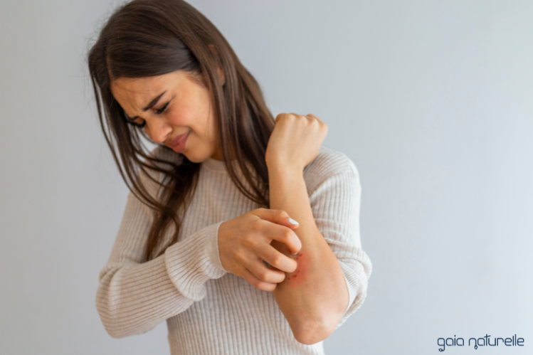Seboroični dermatitis - napake pri zdravljenju