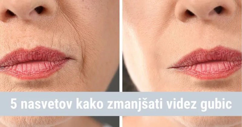 Kaj storiti, ko se pojavijo gubice? - Gaia Naturelle