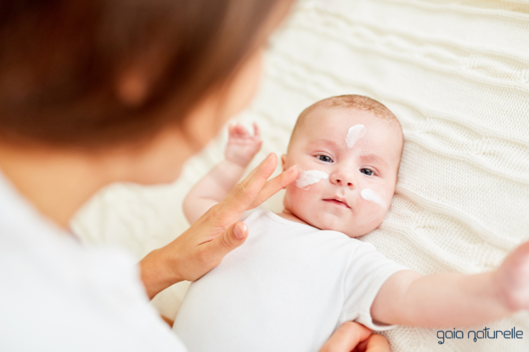 Seboroični dermatitis pri dojenčku