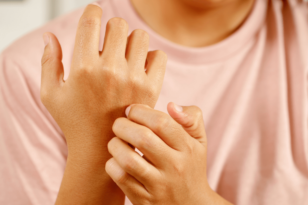 Srbeča koža na hrbtu in nogah: vzroki, simptomi in rešitve - Gaia Naturelle