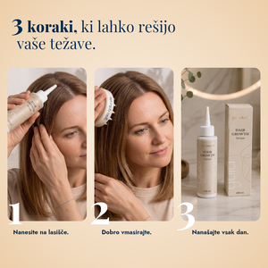 Serum za rast las