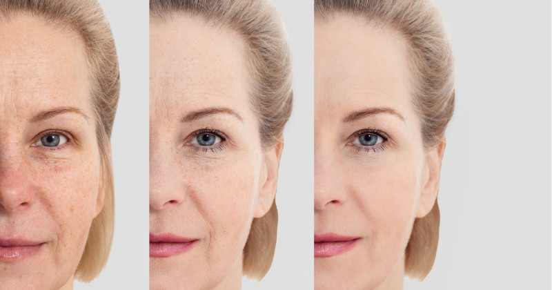 5 nasvetov kako upočasniti staranje kože - ohranite mladostni videz