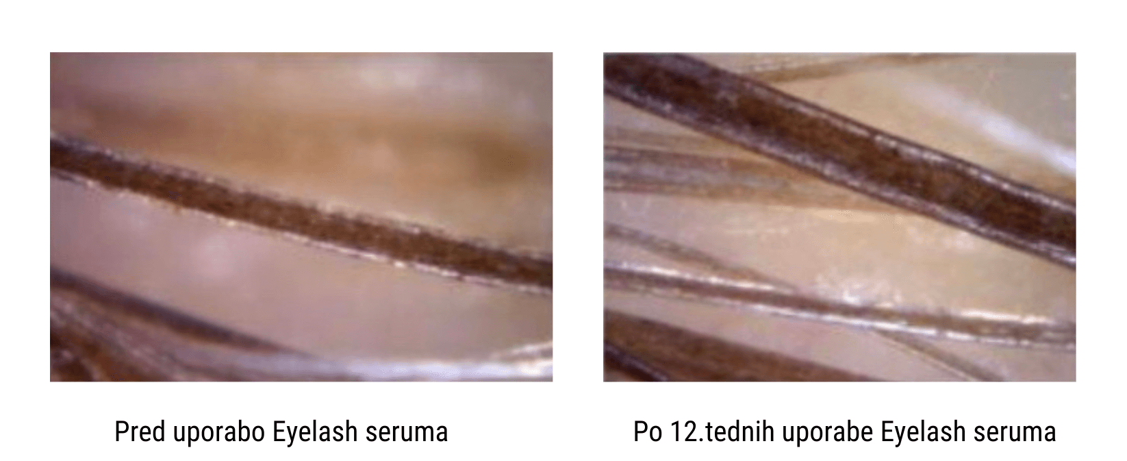 Učinki Eyelash seruma