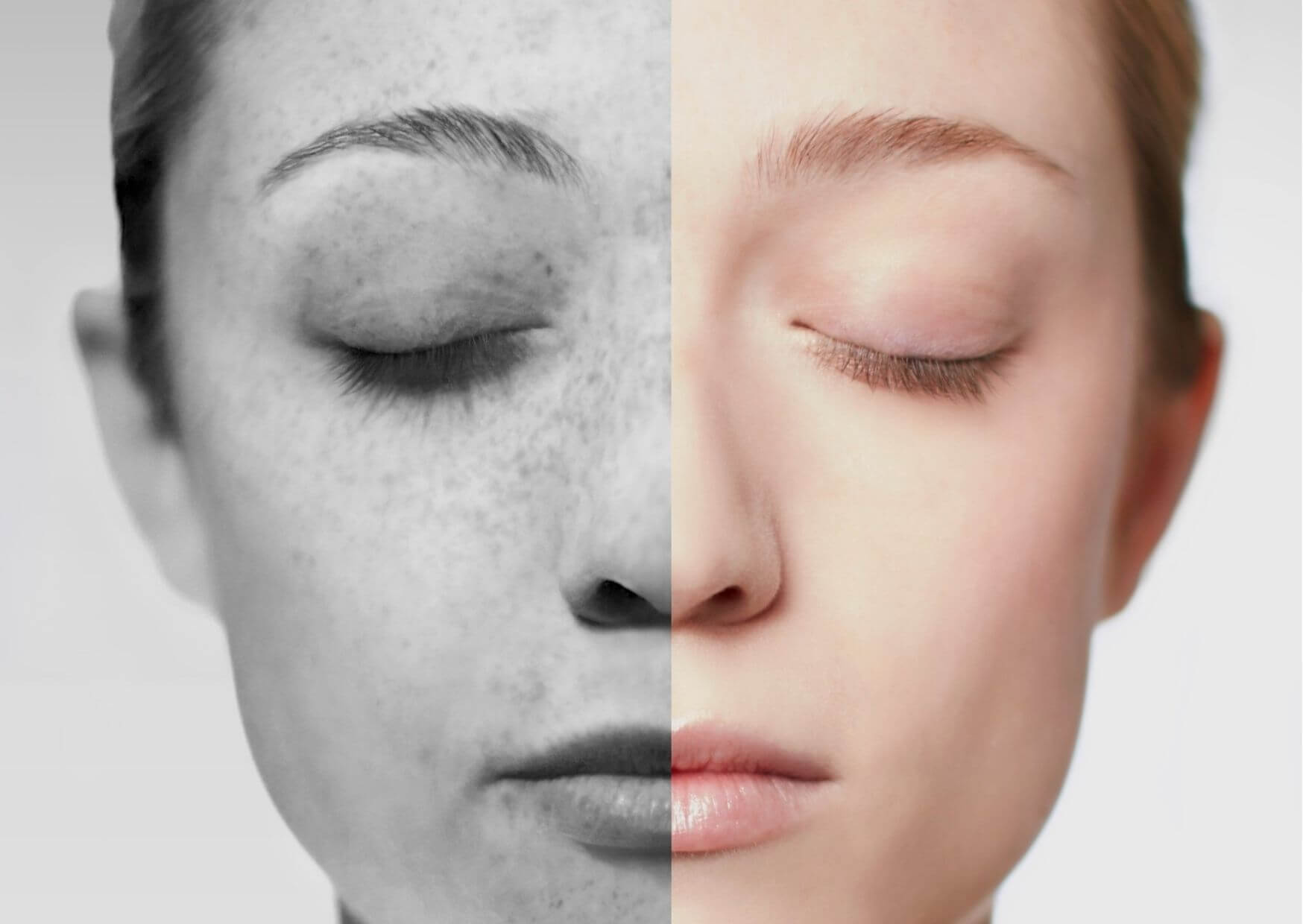 Vidne poškodbe na koži, ki so posledica UV-sevanja