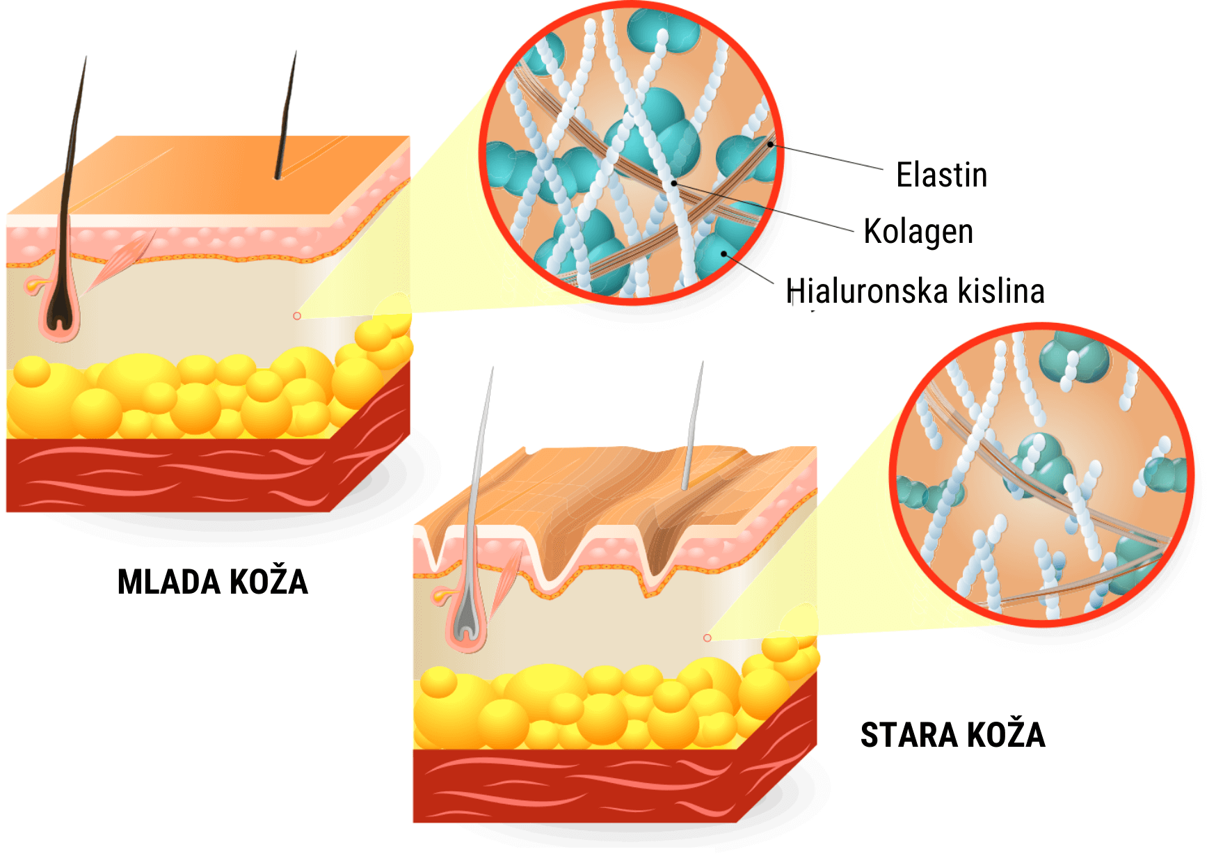 Hialuronska kislina za sklepe in njen vpliv na kožo