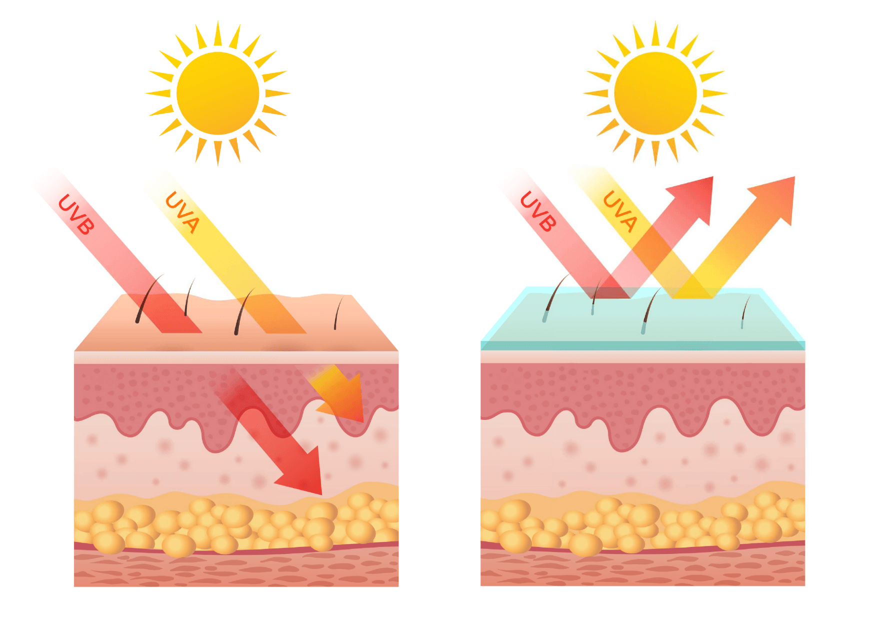 UV- sevanje vpliva na prezgodnjo staranje kože